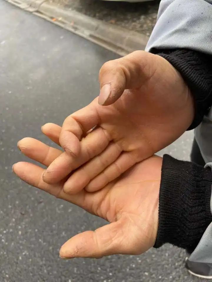 健身手套防起茧_健身手套老茧_手套健身老茧怎么去掉